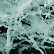 Fibrous masses from insulin