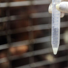 hand holding a vial filled with breast milk 