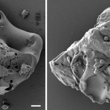 Black and white micrographs. Looks almost like coral.