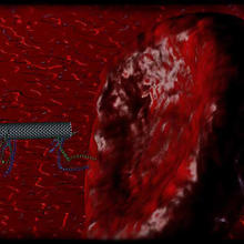 Artist rendition of a tiny robot approaching a malfunctioning red blood cell