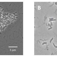 A naeslundii disaggregation
