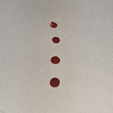 Photo of blood droplets