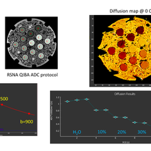 MRI diffusion phantom