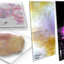 Freshly dissected tissue (lower left) and its pathology-prepared slide with identified tumor regions by a pathologist (upper left), and a pseudo-color image of hyperspectral dark-field microscopy (HSDFM) data cube (middle) region marked on the tissue images on the left.