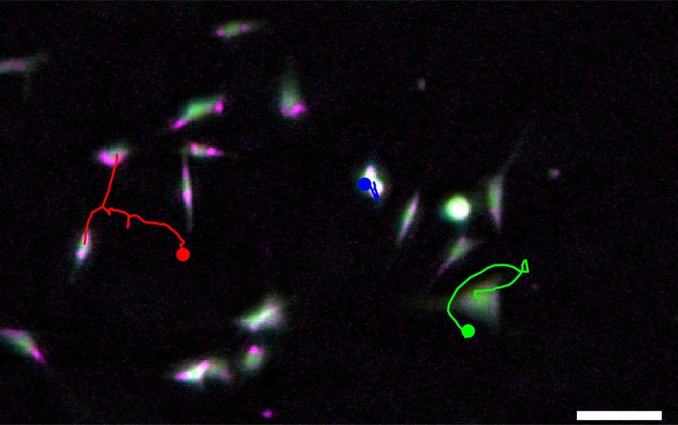 An image of tiny cells highlighted in green, blue and red against a black background.