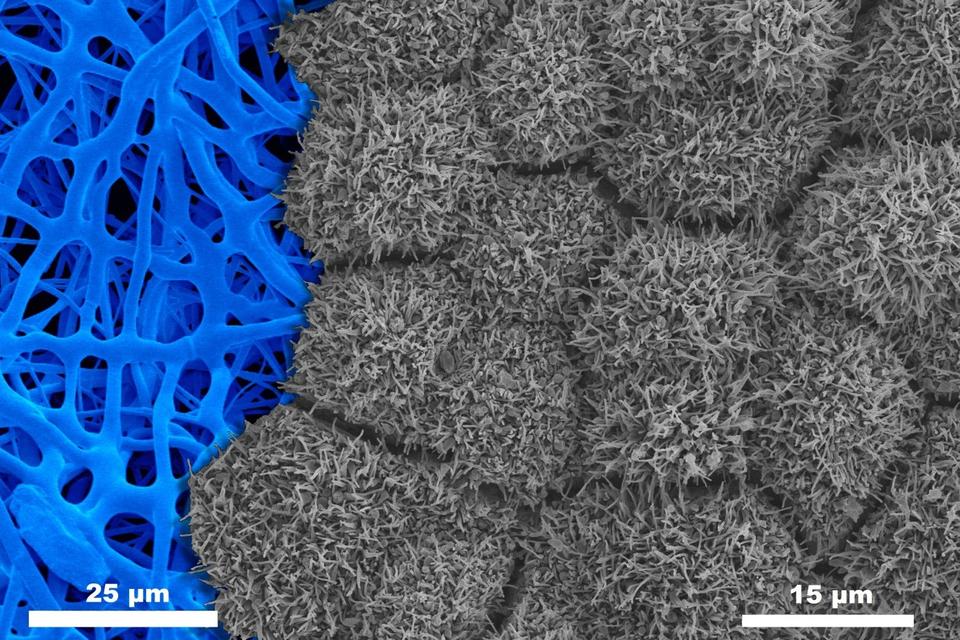 Scanning electron micrograph of retinal pigment epithelium (RPE) cultured on a nanofiber scaffold. RPE and nanofibers were imaged separately and combined. Details in image caption. 