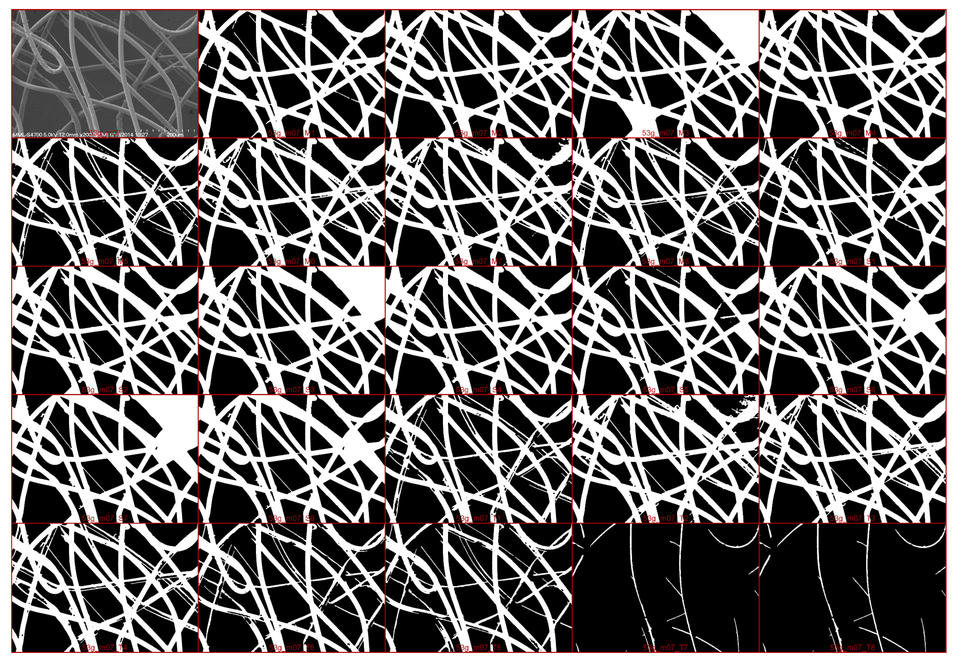 Micrograph image segmented into background and foreground by DiameterJ software. Original micrograph plus 24 segmentations used for image analysis. Details in image caption. 